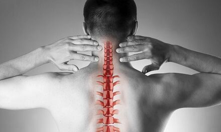 Come si manifesta l'osteocondosi della colonna cervicale