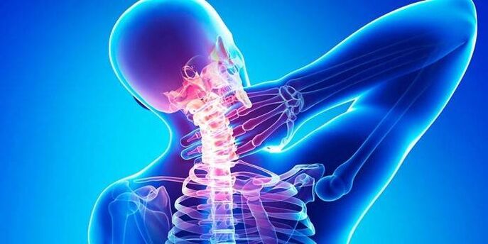 osteocondrosi cervicale
