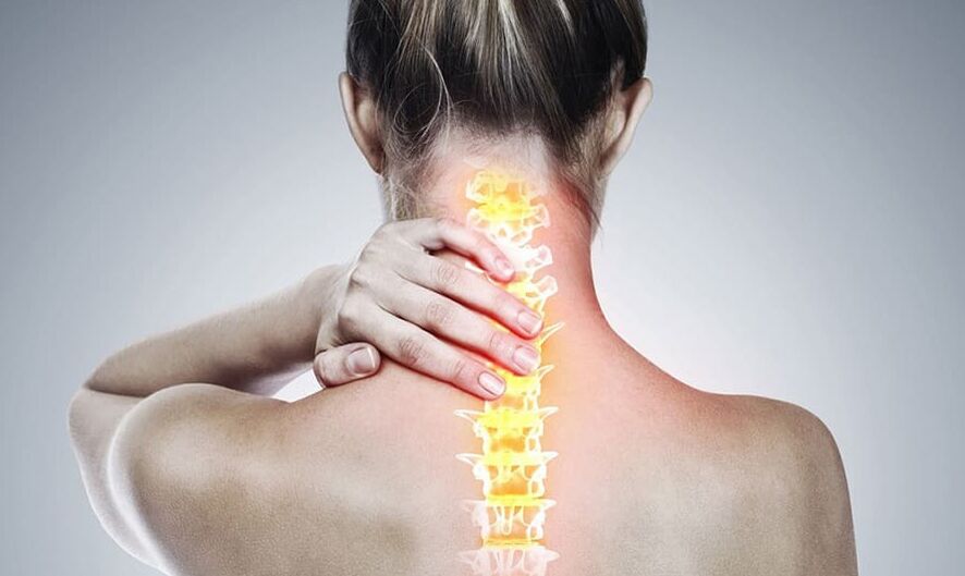 Osteocondrosi del rachide cervicale